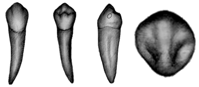 上颌第一前磨牙与下颌第一前磨牙的形态,解剖特点