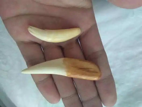 最直接的鉴别老虎牙的方法