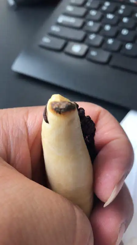 是树脂的很好鉴定,你可以拿刀片轻刮虎牙出来粉末后用打火机烧一下