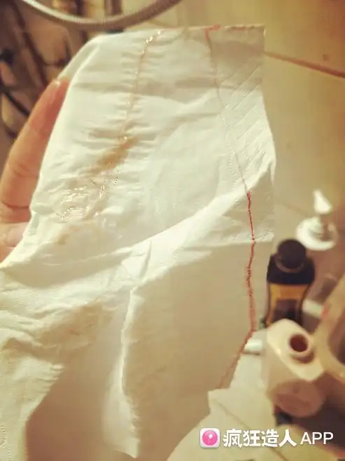 排卵期出血,有这样姐妹好孕的吗?