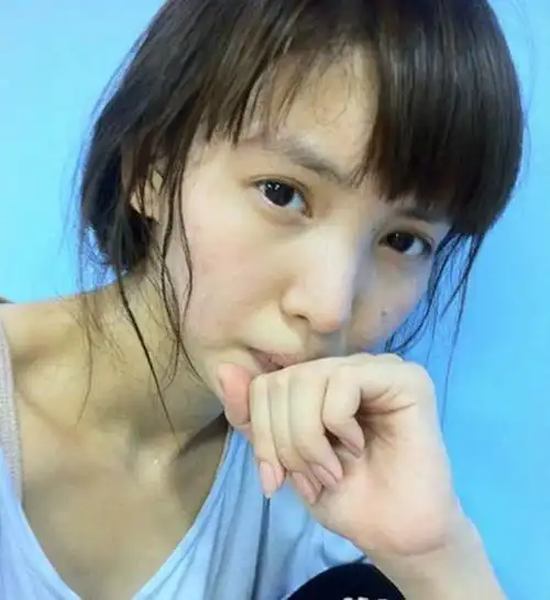 金晨素颜皮肤底子还不错,就是有不少的痘痘,但肤色还是挺白的.