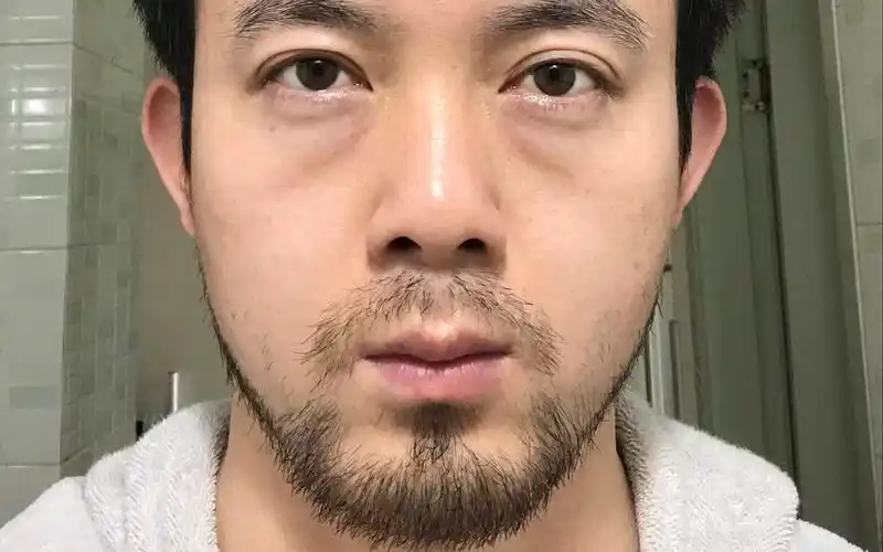 北冰杨手动剃须刀解决留了20多天的络腮胡子前后对比巨大场面极度舒适