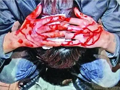 下夜班路上"飞来"啤酒瓶 小伙被醉汉砸得头破血流