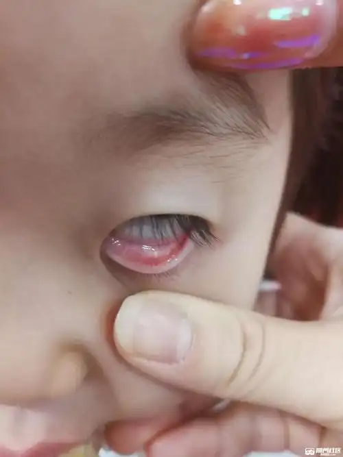 眼睛这个白点是啥