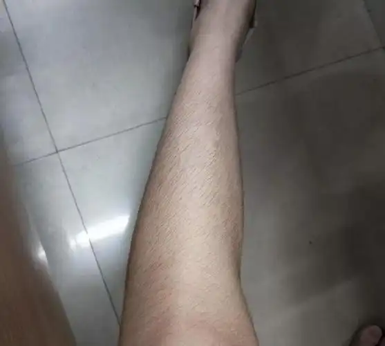 我女的汗毛有4cm长