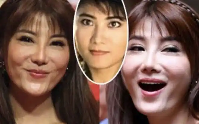 中年女星整容后遗症一堆!脸像鞋拔子,不敢做大表情,演戏没法看