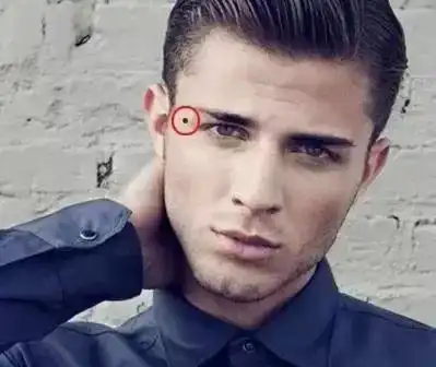 "财痣",哪里有痣能发财,快看看你有吗?