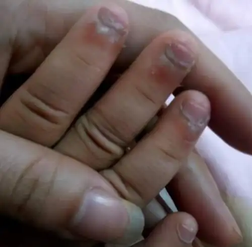 "修剪指甲全靠嘴啃",孩子从小啃指甲,长大会面临"尴尬"处境