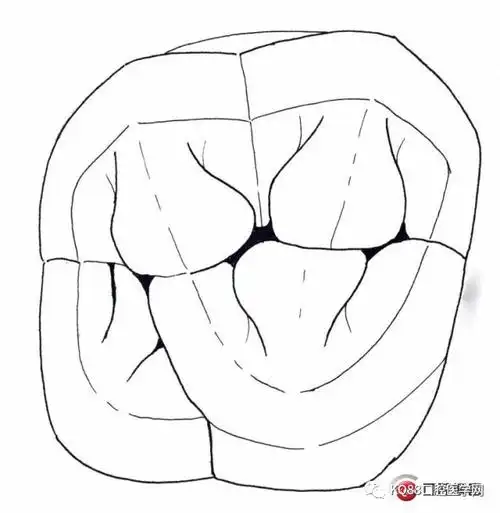 随手画的再来一遍(还是丑)是不是很帅气接下来就算是下颌第一前磨牙了