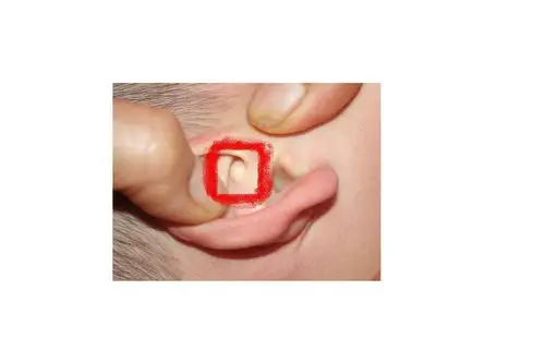 儿科 小儿外科 小儿骨软骨瘤 2012-06-09 18:52:49 提问人:aske3wu3