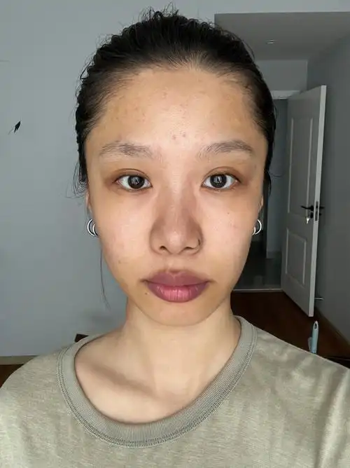 黄黑皮有多少种可能性?