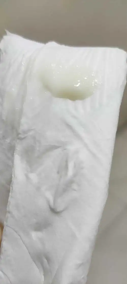 白带酸奶稠浆糊状 一年了 啊啊啊 崩溃