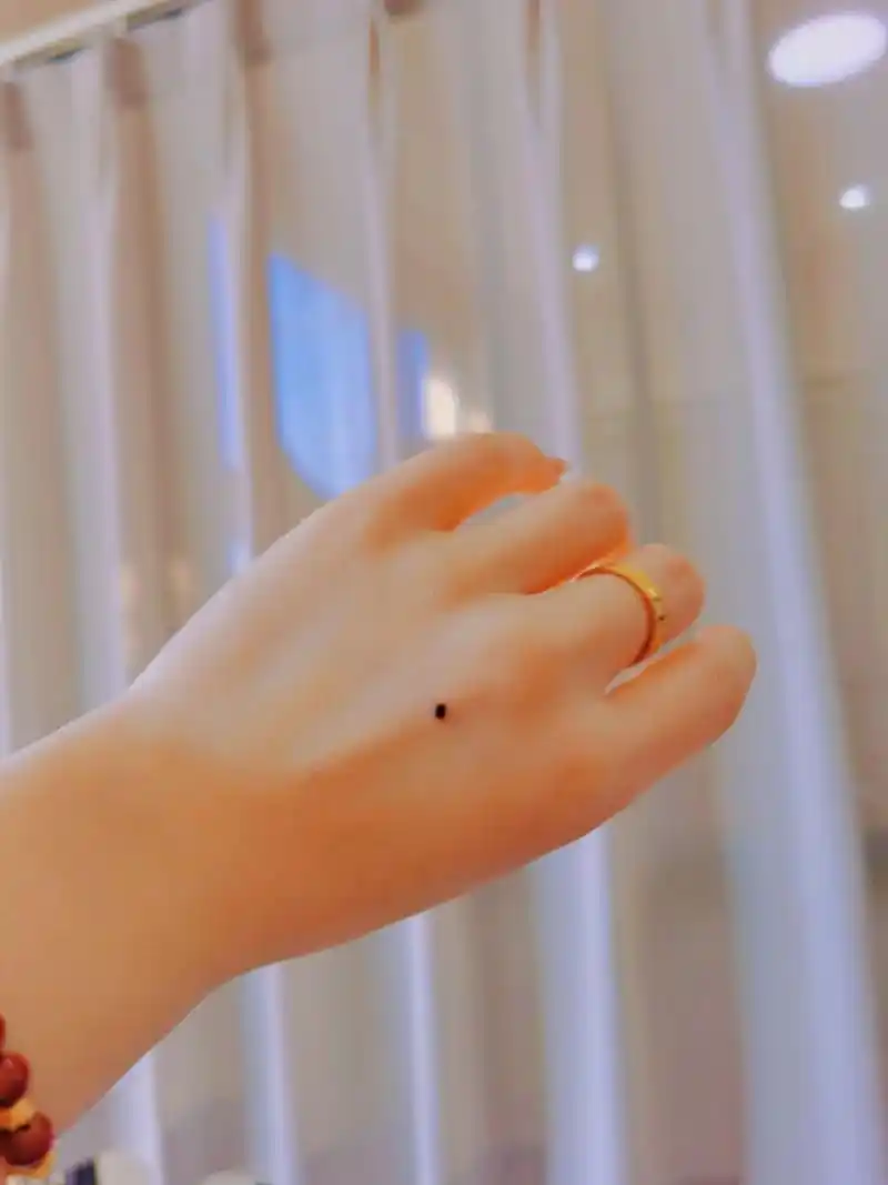 曾听人说 手背长痣 衣食无忧 事业运势好左手背长痣 时来运 - 抖音