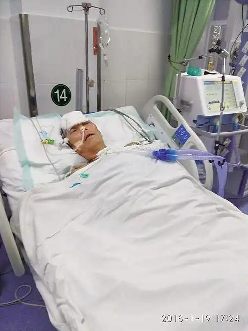 躺在病床上的符世群.