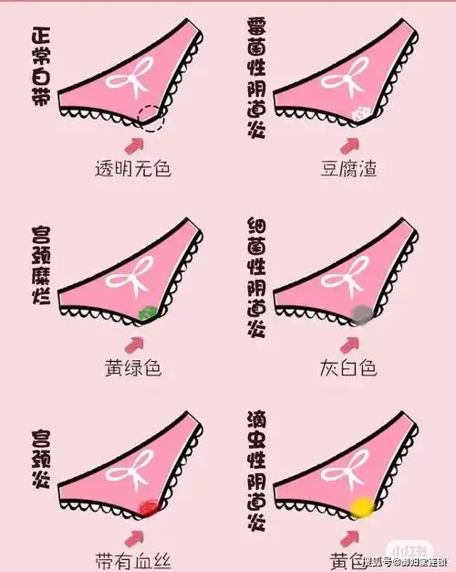 白带突然变得清澈如水,经常弄湿内裤,并伴有臭味?