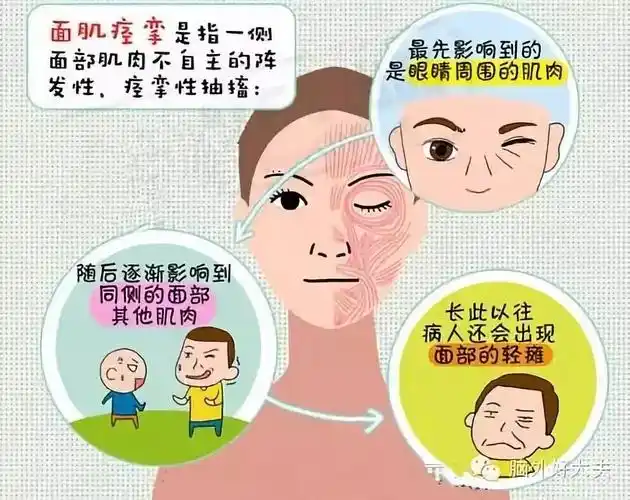 具体就广州和谐医院神经修复医学中心为大家介绍:面肌痉挛患者生活