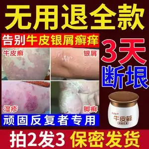 止痒药膏皮肤抑菌止痒外用