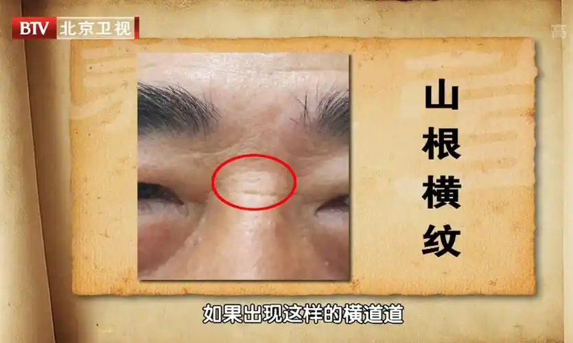 经典重播-安徽公共频道循环播出《养生堂》健康访谈_北京德胜门中医院