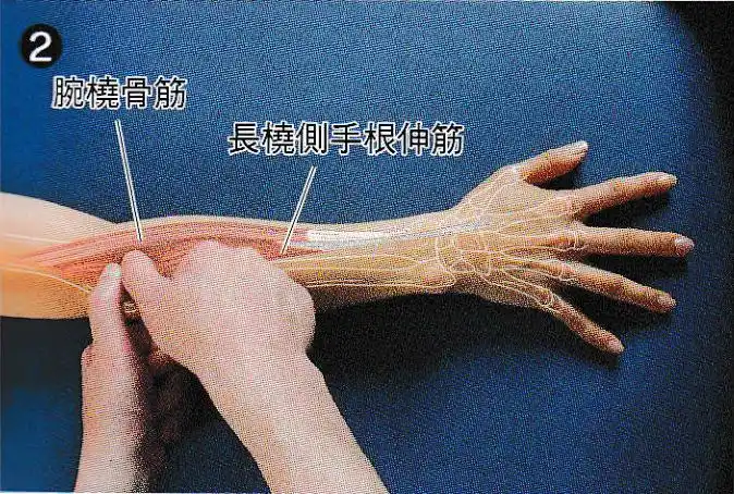 康复触诊新章节52桡侧腕长伸肌下