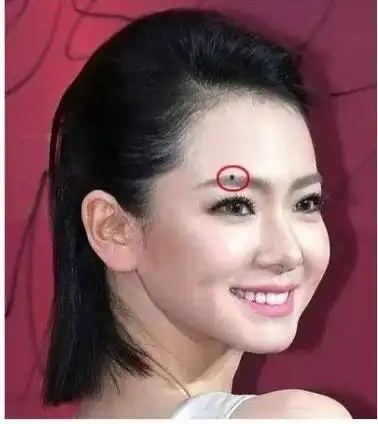 代表了左财右寿,天生就是福气痣,所以如果眉毛中间有痣,他们天生就是