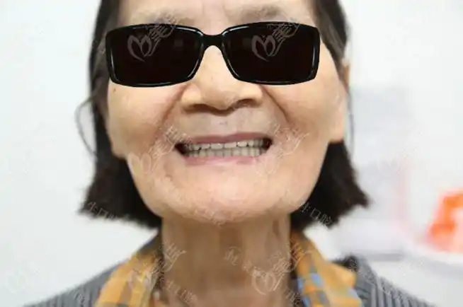 广州中家医家庭医生口腔的价格这么便宜,那它做全口种植牙靠谱吗? -