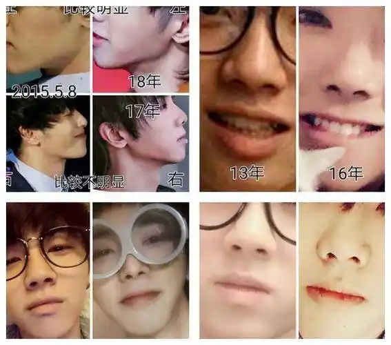 原创明明脸型由大变小为何拒不承认整容手术