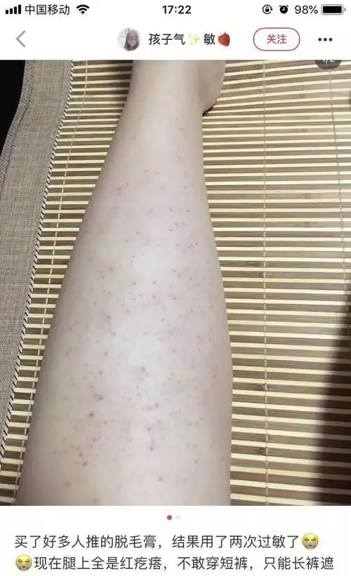 破坏毛发正常生长堵塞毛孔,造成毛囊炎其中的化学物质进入皮肤而且