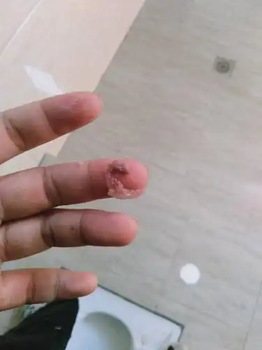 专业安心!移植后坐车颠簸会掉吗"价格公道"-第1张图片-康夫博客