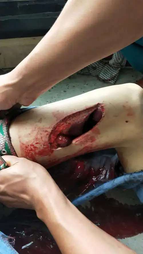 生死时速抢救忙——瑞康医院创伤中心纪实.