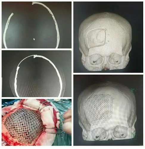 宜春新建医院神经外科简介