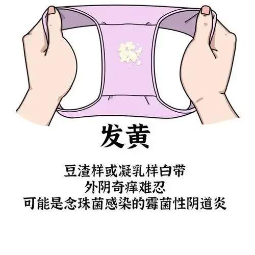 被带进女性体内这时候内裤就会因为白带异常而变得五彩斑斓说这么多
