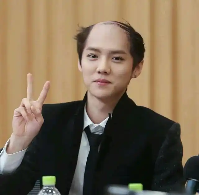 发顶脱光,颜值掉了8成,没想到这个"老法"让头发重回茂盛