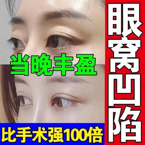 眼窝凹陷修复填充眼贴丰泪沟改善眼皮松弛眼眶提拉紧致神器