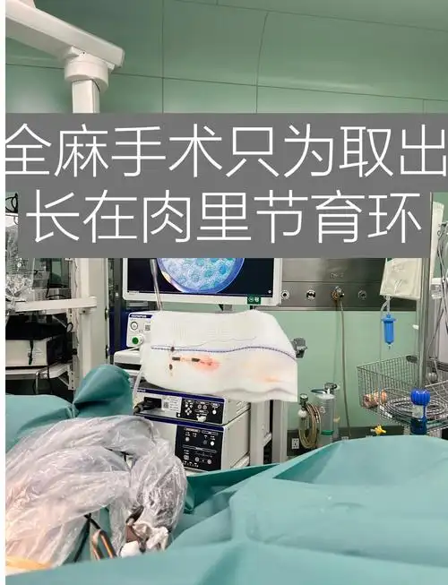 医生建议住院取环,最终通过宫腔镜手术成功取出