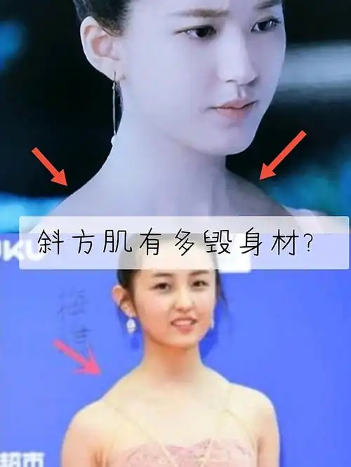 why首当其冲的不是圆脸,而是发达的斜方肌偏厚的背部!