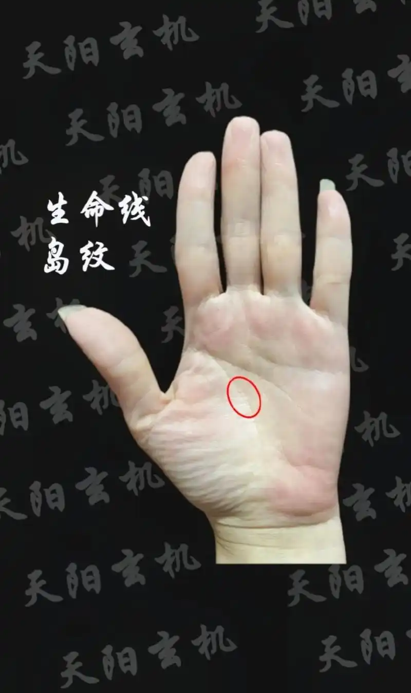 金星丘偏薄,体质不佳,生命线初期也见锁链,根基偏弱.但是此处 - 抖音