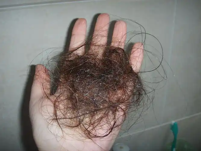 这样的头发掉的算厉害吧?(有照片),急!