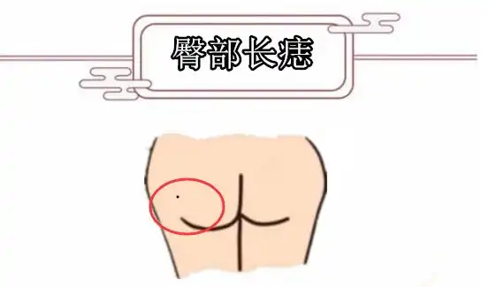 "千金难买5颗痣",颗颗带财,男人升官不愁,女人发财不愁!_腾讯新闻