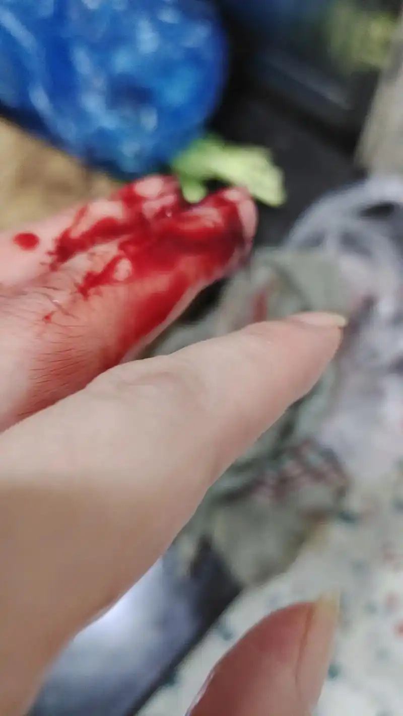 一不小心切菜切了手,成人的世间没有容易二字,没有矫情,累了自 - 抖音