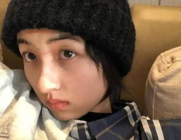 原创张子枫答应粉丝晒自拍一口气发4张素颜照额头上还有痘印