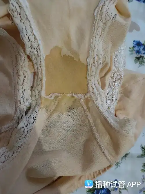 怀孕十周,分泌物水样,每天内裤都会湿