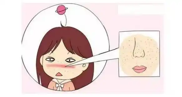 毛孔粗大,还怎么做小仙女?-李石主治医师-爱问医生