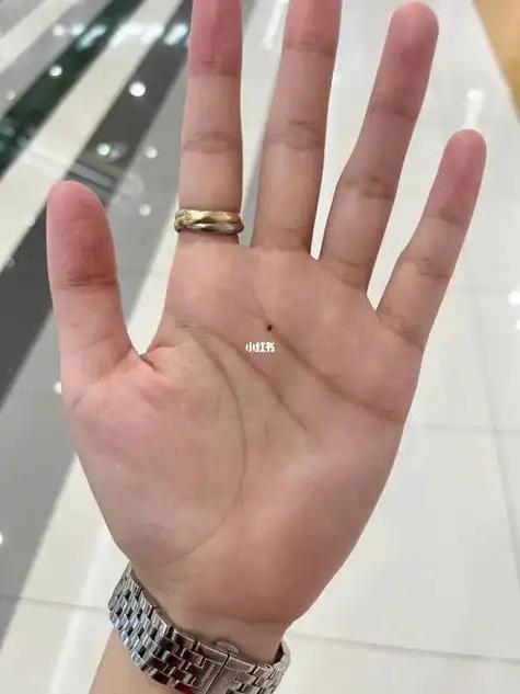 手心痣吉凶 女生左手手心长痣图解-神机妙算网
