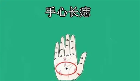 女人右手掌心有痣图解