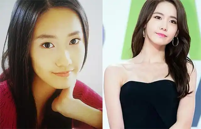 林允儿整容前后 简直让人无法直视