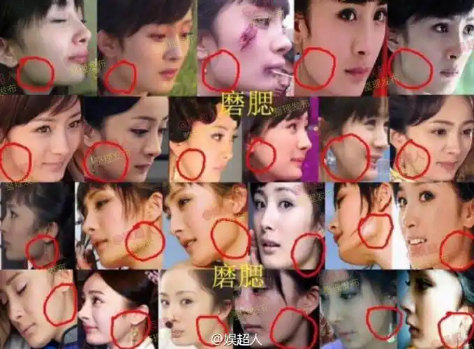 杨幂整容了吗 杨幂整容对比-文化号