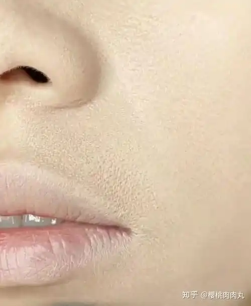 冬季脸上干燥起皮严重 该怎么办呢?