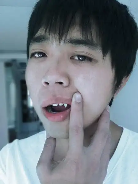 昨晚宿醉过后  还长出颗尖牙  身上做手术的刀疤不见了  我这是怎么了