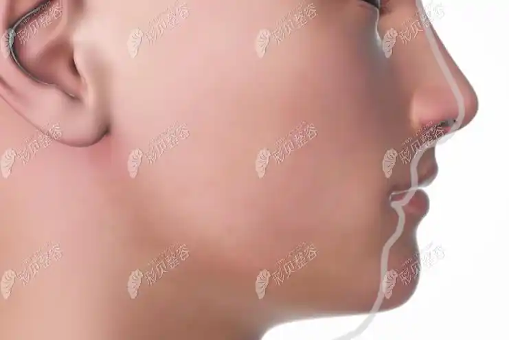 下巴往前翘侧面好丑怎么矫正一笑起来脸弯的像月亮一样