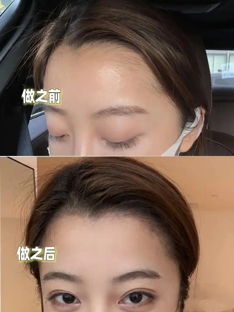 纹发际线绝对是一个平价又高效自然的选择